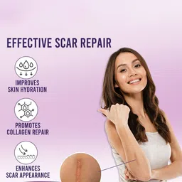 Sanfe Silicone Scar Sheets - 2 Sheets image 4