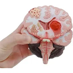 A-ONE SCIENCE Multicolor PVC Brain Stroke Model AOSBM152 image 2