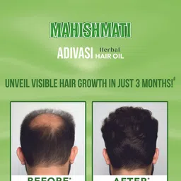 KISRA Set Of 3 Mahishmati Adivasi Herbal Hair Growth Oil - 100 ml Each image 3