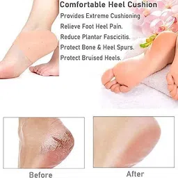 yopram Silicon Anti Crack Heel Pain Relief Moisturizing Socks for Men and Women Ankle Support image 4