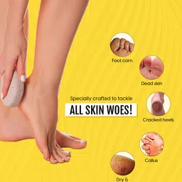 MATRA Set of 2 Pumice Stone Pedicure Foot Scrubber image 4