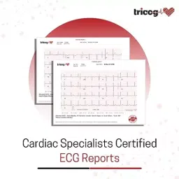Tricog ECG Machine 12-Lead Portable Grey, Vcardia image 3