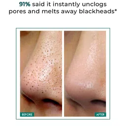 Conscious Chemist Blackhead Melting Water - 100 ml image 4