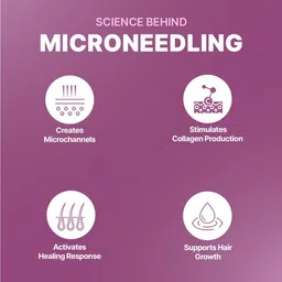 kg import KGIMPORT Derma Roller For Hair Growth 0.5 mm with 540 Titanium Needles image 4