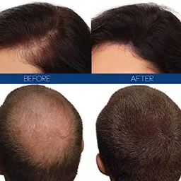 Hair4Real Hair Building Fibers, Dark Brown, 12 g image 2