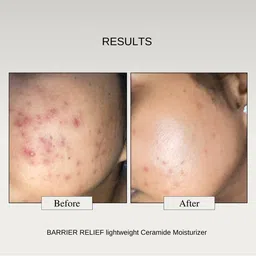 the formularx Barrier Relief Lightweight Ceramide Moisturizer image 4