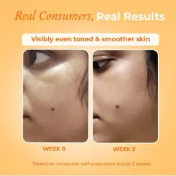 the pink foundry Brightening And Exfoliating Vit-C Daily Face Wash image 5