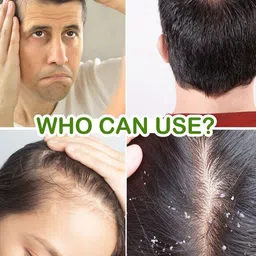 Jovees Rosemary Water Spray With Follicusan DP For Hair Growth & Prevent Dandruff- 200 ml image 3