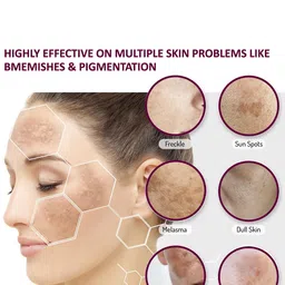 7daysnatural 7 DAYS Organic Dark Spots Removal Serum For Pigmentation & Anti-pigmentation - 30ml image 3