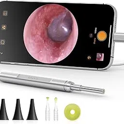 Anykit Digital Otoscope for iPhone, iPad & Android Device, Ultra Clear View Ear Camera with Ear Wax Removal Tools, Video Ear Scope Otoscope with Light, Support Capture Photo & Record Videos-image-51