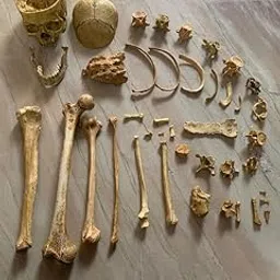 HALF SIDE SKELETON-picture-25