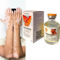 ZeroPathy Skin Brightening Cream for Vitiligo 35ml | Safed Dag Organic Skin | Sada Dag Herbal Spot Repair | Venmai Pulligal White Patch Lightening-picture-47