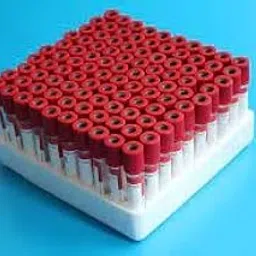 BCT Plain Tube 12x75mm Non vacuum (Pack of 100) (Red)-picture-16