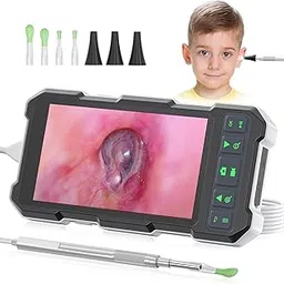 DIMSY Video Otoscope with Camera and Light, 1080P Digital Otoscope with 4.5" IPS Screen, for Adults & Kids, Ear Wax Removal Tool Camera with Ear Cleaner Kit, Plug & Play, 3000mAh Battery-picture-22