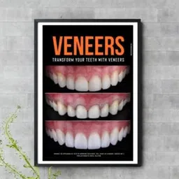 Veneers 3 step Dental poster StatusRing-picture-34