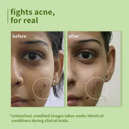 Plum Green Tea Pore Cleansing Face Wash for Oily, Acne Prone, Dry & Combination Skin | with Glycolic Acid | Fight Pimples & Control Excess Oil | Gentle Exfoliating & Non-Drying | Women & Men | 50ml image 3