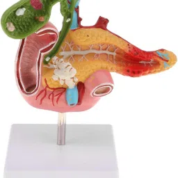 BONEW 1:1 Human Pancreas Spleen Duodenum Gallbladder Pathological Anatomical Model image 2