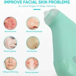 Vacuum Blackhead Machine, Mini Handheld Facial Blackhead Remover for Skin Care (1 Pc) image 3