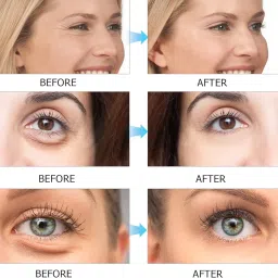 Seaweed Under Eye Patches 60PCS | Collagen Gel Eye Masks for Puffy Eyes, Dark Circles, Wrinkles | Anti-Aging Hydrating Eye Pads with Hyaluronic Acid | Skin Firming & Moisturizing image 2