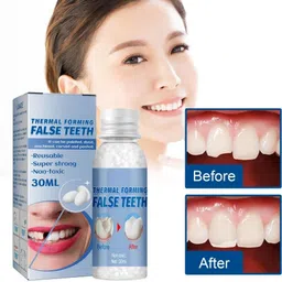 qorelya Temporary Tooth Replacement Kit Simple Dental Repair at Home Teeth Whitening Liquid image 4