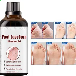 ayyiashi Foot Corn Remover Serum 30ml Fast Acting Safe Clear Skin Care-picture-48