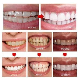beauty que Professional Mint Flavor Advanced Teeth Whitening Strips for Sensitive Teeth image 4