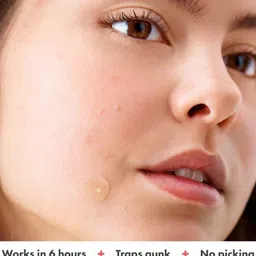 TLISMI Acne Cover Pimple Patches With Hydrocolloid - 36 Patches image 4