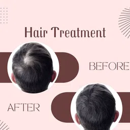 Hayami Hair Growth Serum With 1% Anagain- 30 ml image 4