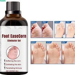 ayyiashi Foot Corn Remover Serum Instant Relief 30ml Fast Acting Solution-picture-26