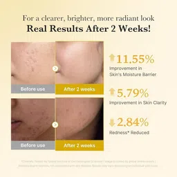 Medicube Kojic Acid Turmeric Niacinamide Serum - 30 ml image 2