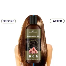 Park Daniel Set Of 3 Reetha Hair Oil - 100ml Each image 4