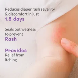 Areoveda Diaper Rash Cream with Zinc Oxide & Oats, Soothes Diaper Rash, Safe From Day 1 image 4