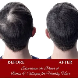 Xpel Marketing Biotin & Collagen Shampoo - 400 ml image 2