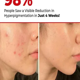 Conscious Chemist 5 Antioxidant Complex Rapid Glow & Brightening Essence - 15 ml image 5