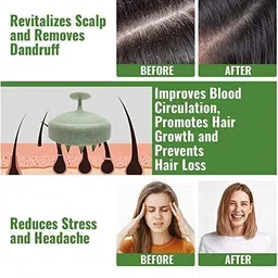 squzaz Scrubber Exfoliator for Dandruff Itchy Flaky Scalp, Works for Wet and Dry Hair image 4