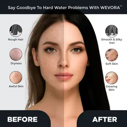 wevora Filter for Hard Water | Hair & Skin Protection | Shower & Faucet-Compatible Fixed Mount image 3