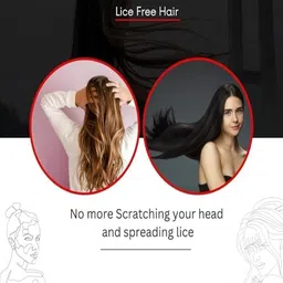 Dudley Set Of 2 Stainless Steel Lice Removal Comb image 2