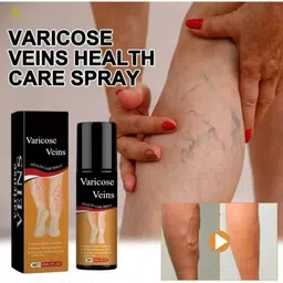 aeyurbs Varicose Vein Relief Spray | Natural Cooling For Veins Liquid image 3