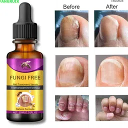 fangruik Nail Fungal Repair Serum with Nail Healing Formula-picture-43