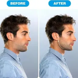 TIKHARO Jawline Exerciser and Toner, Face and Neck Workout Tool, Stress Relief Device image 1