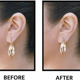 ablue clipper Disposable Ear Lobe Support image 4