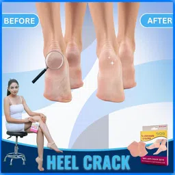 bos medicare Anti Crack Silicon Foot Full Length Foot Heel Support (Beige) Heel Support image 4