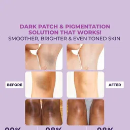 Sanfe Set Of 2 Spotlite Mask For Dark Underarms, Neck & Body - 100 g Each image 4