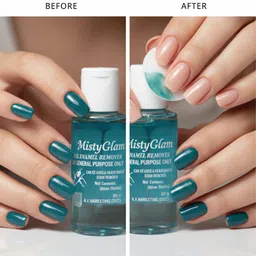 mistyglam Nail Polish Remover | Acetone-free | Easy Removal 50Ml pack of 1 Send Any color image 2