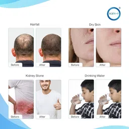 scaleo by scale-o Whole House Water Softener for Tanks, Reduces Hard Water & Scaling Problems Solid Filter Cartridge image 4