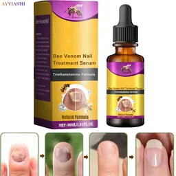 ayyiashi Bee Venom Enriched Safe Nail Serum Promotes Strong Clear Nail Care-picture-41