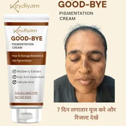 driddle Pigmentation removal cream for women Acne Scar Removal Dark Spots Stretch Marks-picture-13