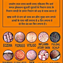 SANJEEVANI AUSHDHIY super cream fungal infection pack of 2 image 5