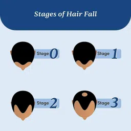 house of common Derma Roller For Growth 0.5 mm with 540 Titanium Needles to use Personal Care Appliance Combo image 5