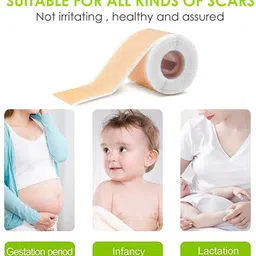 lonien Silicon Gel Sheet for Scars Transparent Medical Silicone Gel Tape for Scar Crepe Bandage image 4